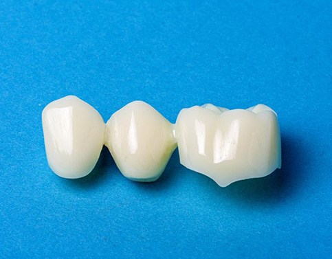 Three-unit dental bridge against blue background