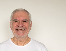 An older man suffering from missing teeth