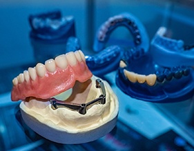 model of implant dentures