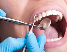 dental checkup in Edison