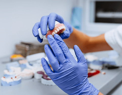 a dental technician constructing an implant denture