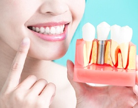 Implant dentist in Edison holding model for dental implants