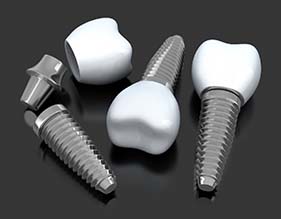 three dental implants with abutments and crowns