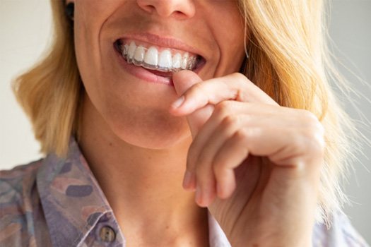 Straighten your smile with Invisalign near Clark