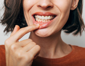 You may need scaling and root planing if you have advanced signs of gum disease