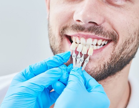 man being fitted for veneers