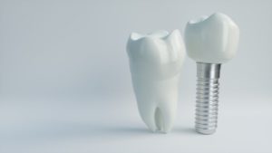 model of implant-retained crown next to model of natural tooth 