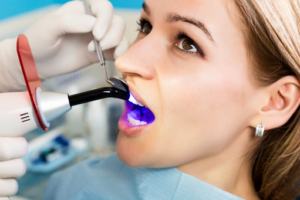 Dentist whitening his patient’s teeth
